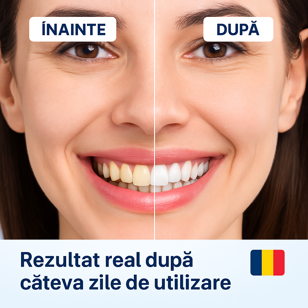 1+2 Gratuit – Canetă Pentru Albirea Dinților