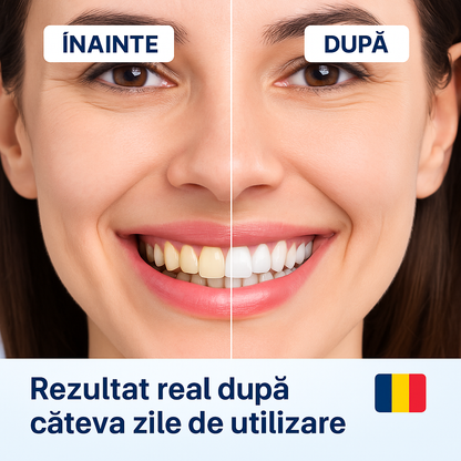 1+2 Gratuit – Canetă Pentru Albirea Dinților